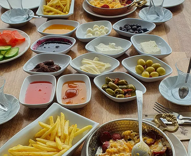 Özel Seçenekler görseli